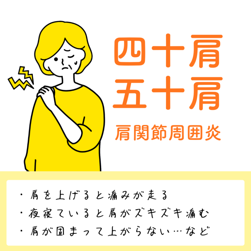 四十肩・五十肩（肩関節周囲炎）